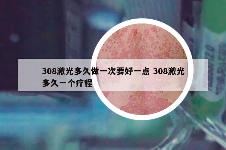 308激光多久做一次要好一點 308激光多久一個療程