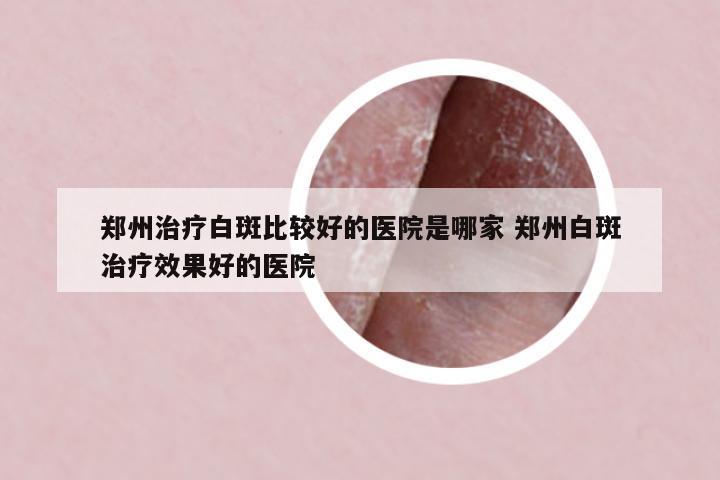鄭州治療白斑比較好的醫(yī)院是哪家 鄭州白斑治療效果好的醫(yī)院
