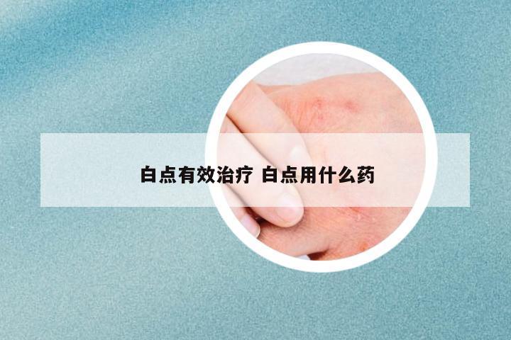 白點(diǎn)有效治療 白點(diǎn)用什么藥