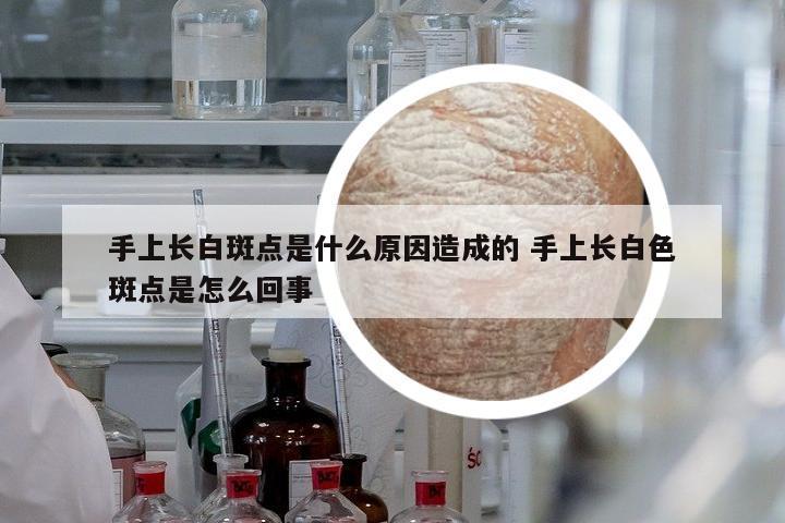 手上長(zhǎng)白斑點(diǎn)是什么原因造成的 手上長(zhǎng)白色斑點(diǎn)是怎么回事