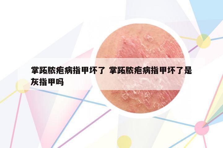 掌跖膿皰病指甲壞了 掌跖膿皰病指甲壞了是灰指甲嗎