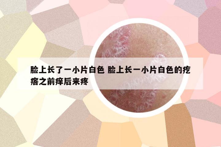 臉上長了一小片白色 臉上長一小片白色的疙瘩之前癢后來疼