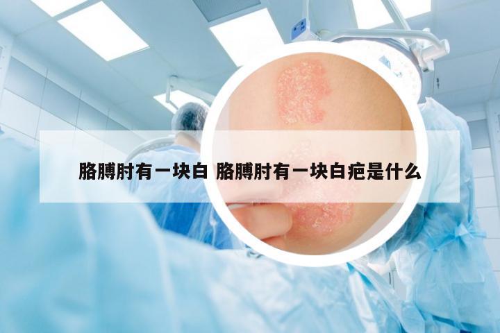 胳膊肘有一塊白 胳膊肘有一塊白疤是什么