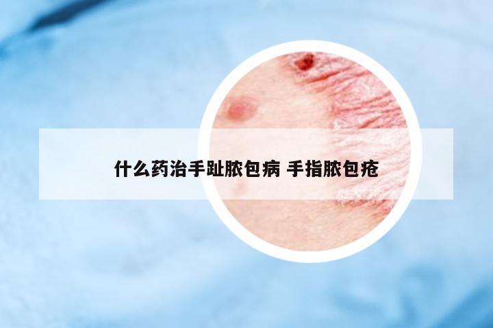 什么藥治手趾膿包病 手指膿包瘡