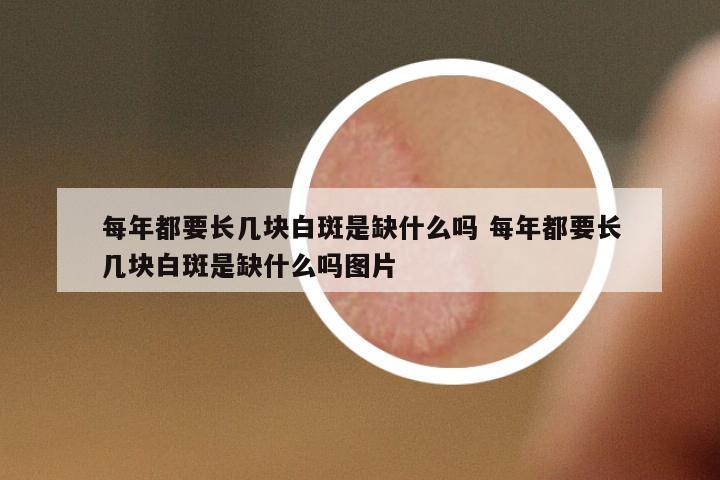 每年都要長幾塊白斑是缺什么嗎 每年都要長幾塊白斑是缺什么嗎圖片