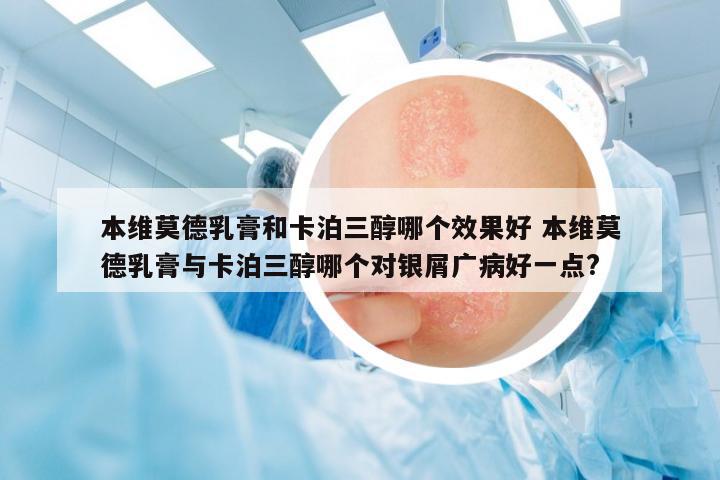 本維莫德乳膏和卡泊三醇哪個效果好 本維莫德乳膏與卡泊三醇哪個對銀屑廣病好一點(diǎn)?