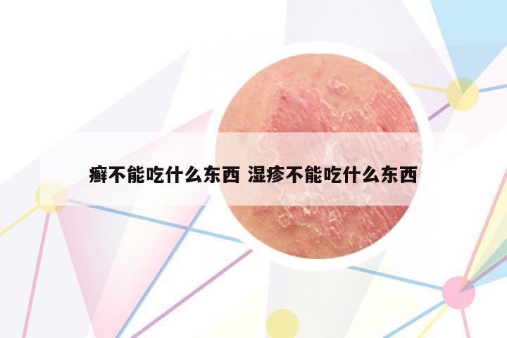癬不能吃什么東西 濕疹不能吃什么東西