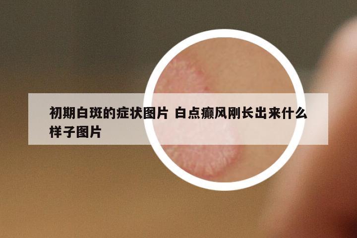 初期白斑的癥狀圖片 白點癲風剛長出來什么樣子圖片