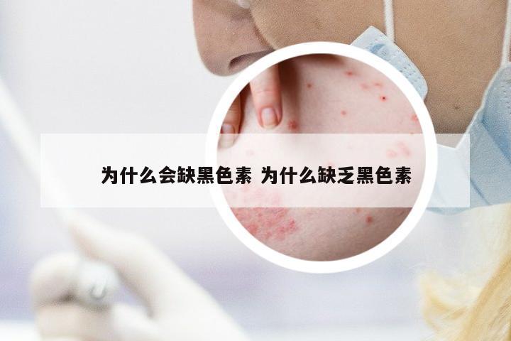 為什么會(huì)缺黑色素 為什么缺乏黑色素