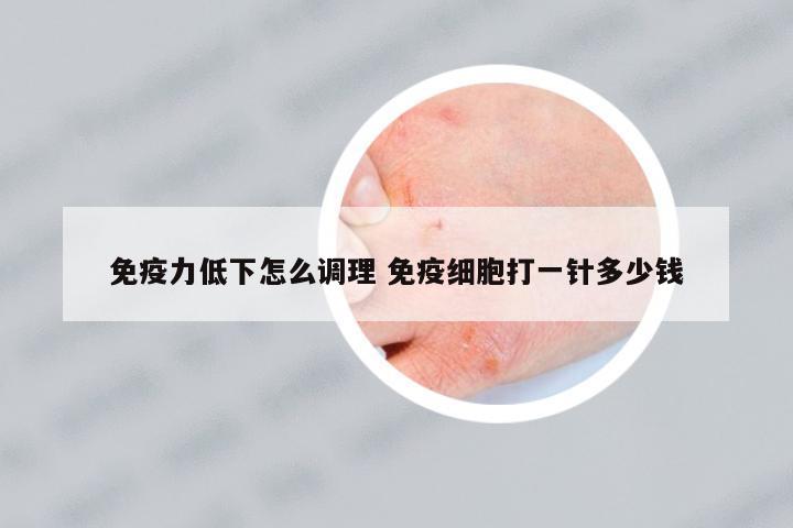 免疫力低下怎么調(diào)理 免疫細胞打一針多少錢
