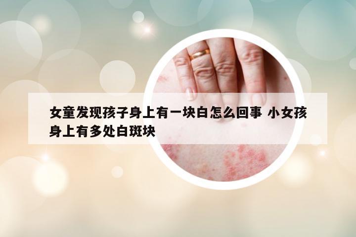 女童發(fā)現(xiàn)孩子身上有一塊白怎么回事 小女孩身上有多處白斑塊