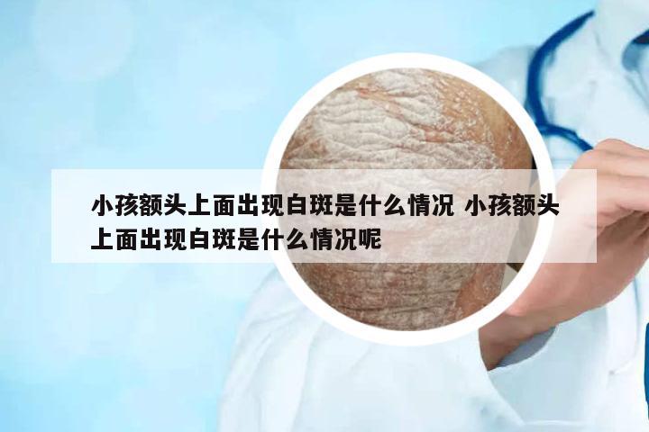小孩額頭上面出現(xiàn)白斑是什么情況 小孩額頭上面出現(xiàn)白斑是什么情況呢