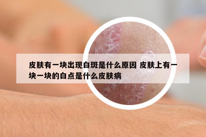 皮膚有一塊出現(xiàn)白斑是什么原因 皮膚上有一塊一塊的白點(diǎn)是什么皮膚病