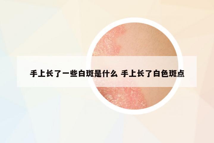 手上長了一些白斑是什么 手上長了白色斑點