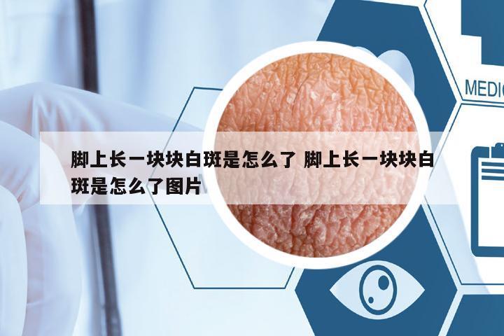 腳上長(zhǎng)一塊塊白斑是怎么了 腳上長(zhǎng)一塊塊白斑是怎么了圖片