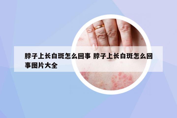 脖子上長白斑怎么回事 脖子上長白斑怎么回事圖片大全