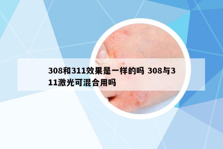 308和311效果是一樣的嗎 308與311激光可混合用嗎