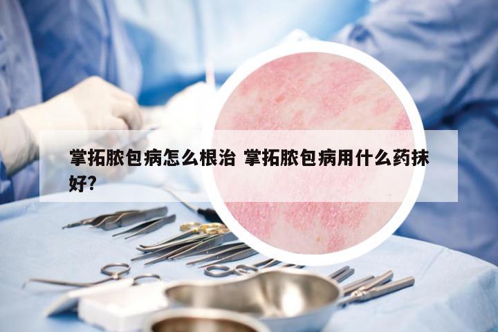 掌拓膿包病怎么根治 掌拓膿包病用什么藥抹好?