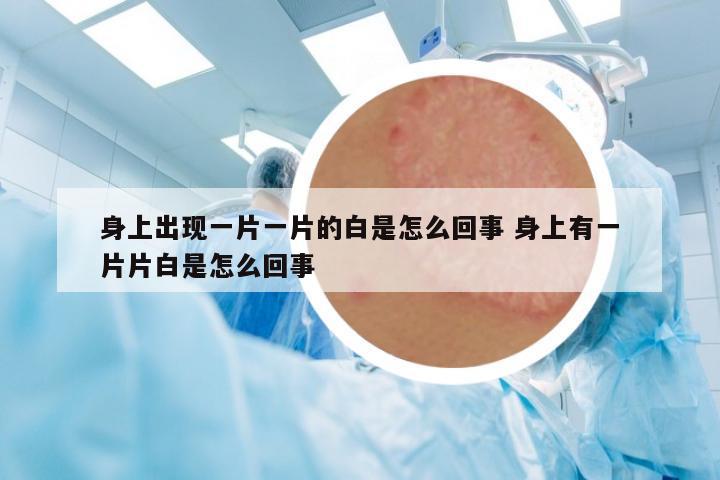 身上出現(xiàn)一片一片的白是怎么回事 身上有一片片白是怎么回事