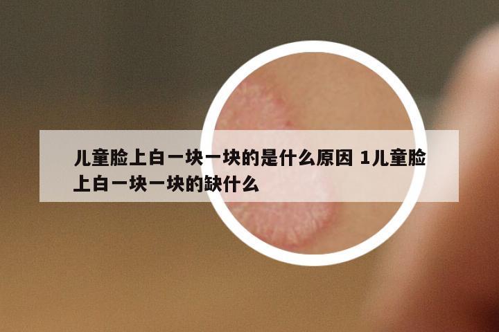 兒童臉上白一塊一塊的是什么原因 1兒童臉上白一塊一塊的缺什么