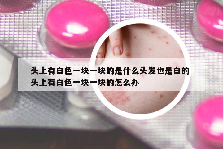 頭上有白色一塊一塊的是什么頭發(fā)也是白的 頭上有白色一塊一塊的怎么辦