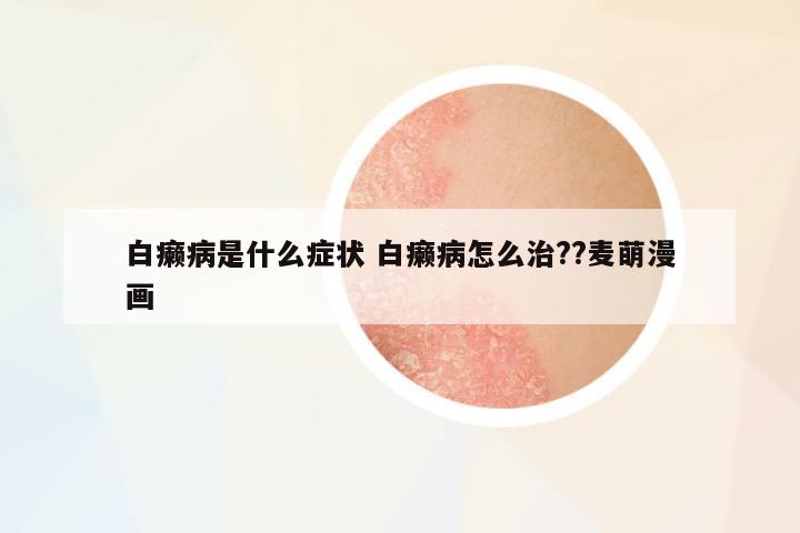 白癩病是什么癥狀 白癩病怎么治??麥萌漫畫