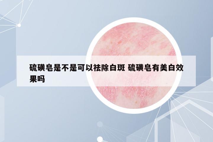 硫磺皂是不是可以祛除白斑 硫磺皂有美白效果嗎