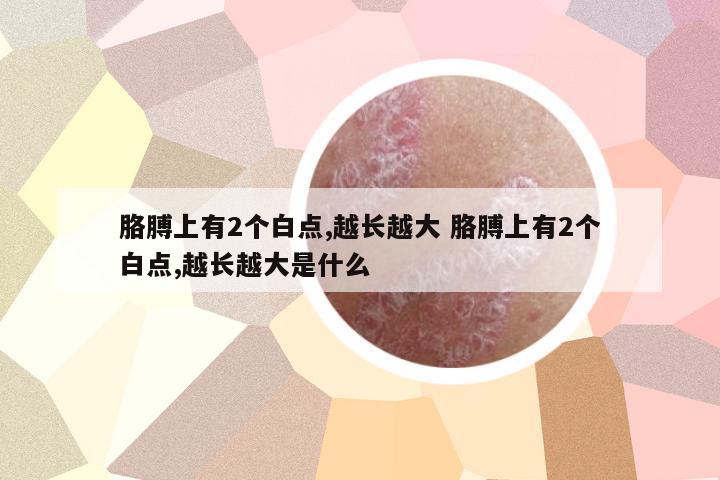 胳膊上有2個白點,越長越大 胳膊上有2個白點,越長越大是什么