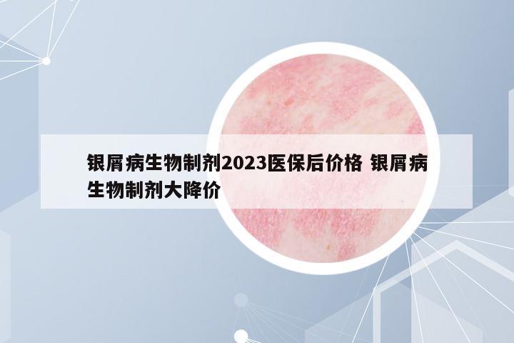 銀屑病生物制劑2023醫(yī)保后價格 銀屑病生物制劑大降價