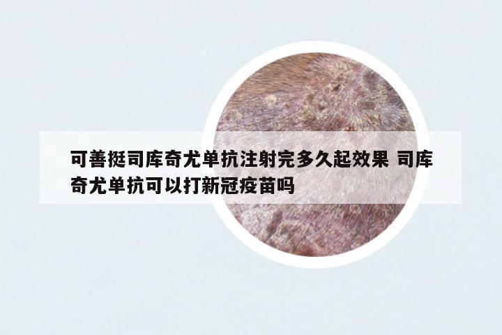 可善挺司庫(kù)奇尤單抗注射完多久起效果 司庫(kù)奇尤單抗可以打新冠疫苗嗎