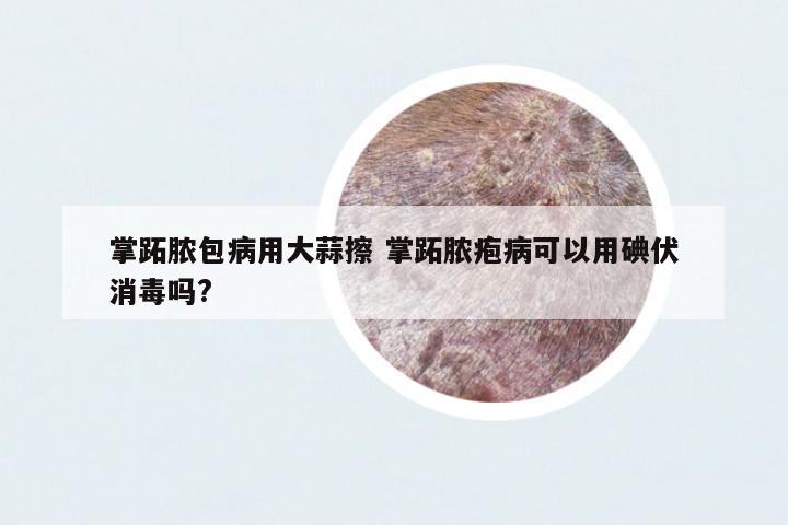 掌跖膿包病用大蒜擦 掌跖膿皰病可以用碘伏消毒嗎?