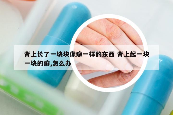 背上長了一塊塊像癬一樣的東西 背上起一塊一塊的癬,怎么辦