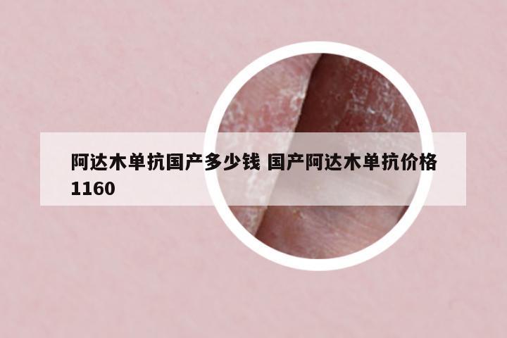 阿達(dá)木單抗國產(chǎn)多少錢 國產(chǎn)阿達(dá)木單抗價(jià)格1160