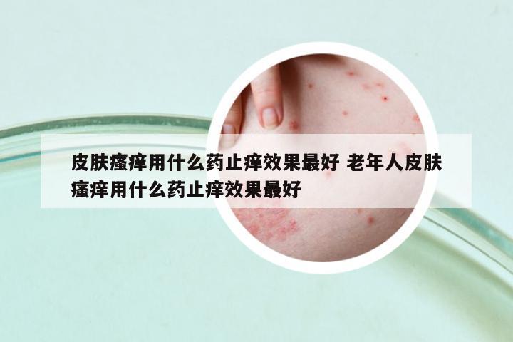 皮膚瘙癢用什么藥止癢效果最好 老年人皮膚瘙癢用什么藥止癢效果最好