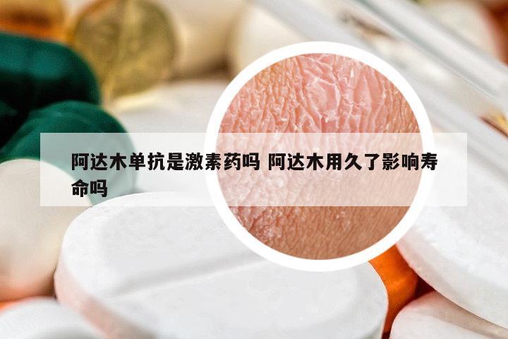 阿達(dá)木單抗是激素藥嗎 阿達(dá)木用久了影響壽命嗎