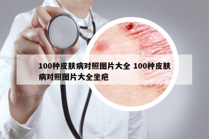 100種皮膚病對照圖片大全 100種皮膚病對照圖片大全坐疤