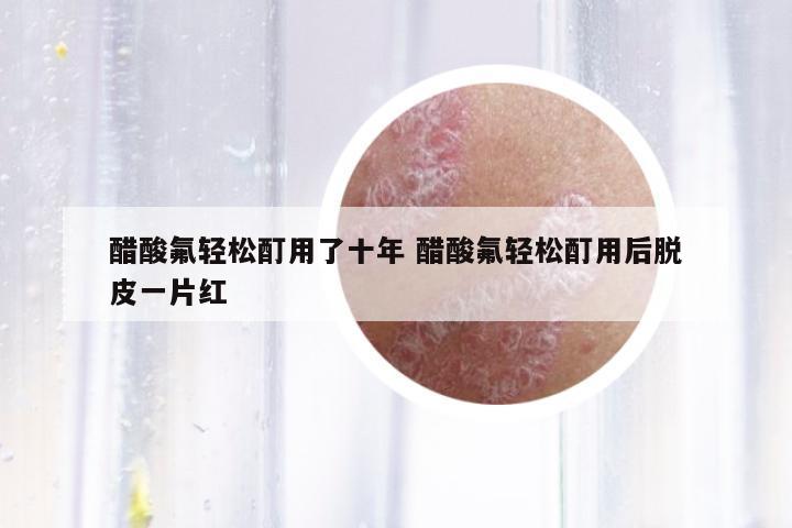 醋酸氟輕松酊用了十年 醋酸氟輕松酊用后脫皮一片紅