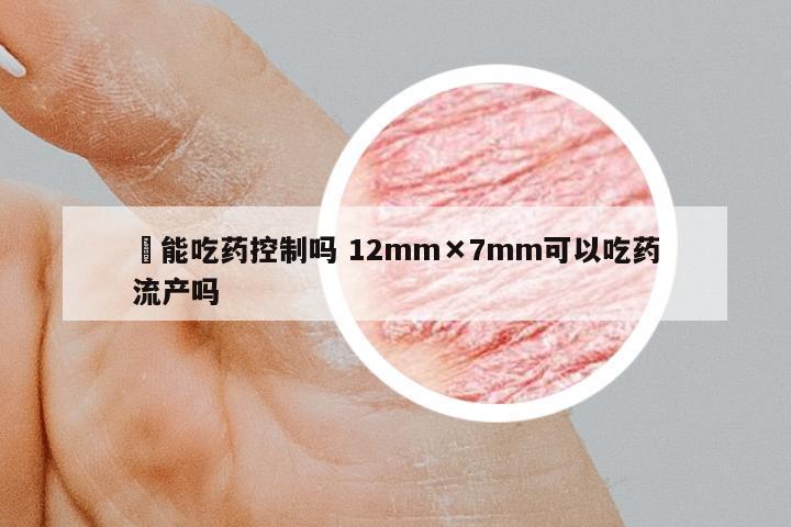 廯能吃藥控制嗎 12mm×7mm可以吃藥流產(chǎn)嗎