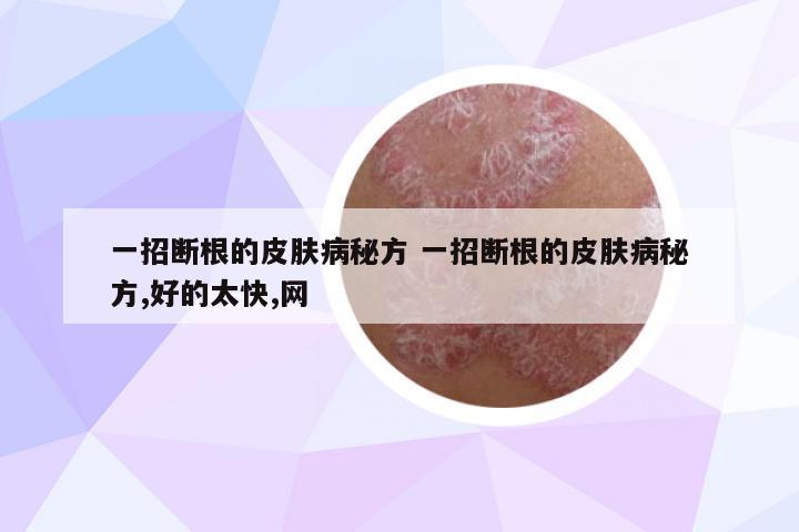 一招斷根的皮膚病秘方 一招斷根的皮膚病秘方,好的太快,網(wǎng)