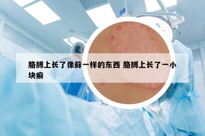 胳膊上長了像蘚一樣的東西 胳膊上長了一小塊癬