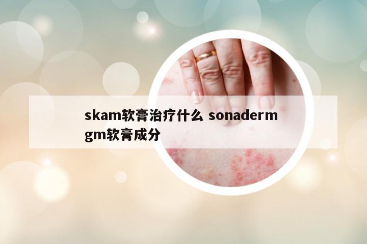 skam軟膏治療什么 sonaderm gm軟膏成分