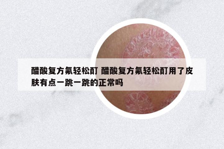 醋酸復(fù)方氟輕松酊 醋酸復(fù)方氟輕松酊用了皮膚有點(diǎn)一跳一跳的正常嗎