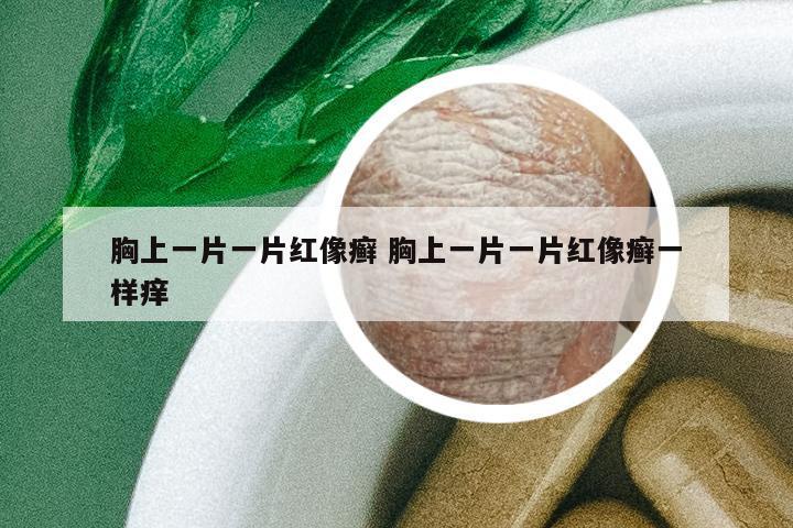 胸上一片一片紅像癬 胸上一片一片紅像癬一樣癢