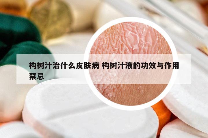 構(gòu)樹汁治什么皮膚病 構(gòu)樹汁液的功效與作用禁忌