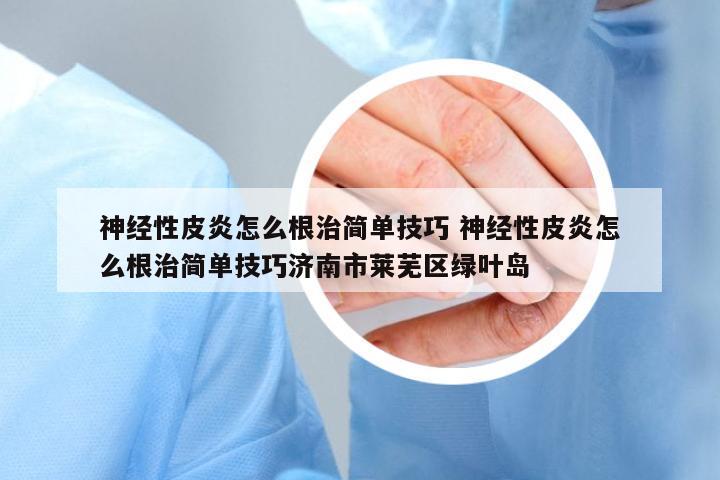 神經(jīng)性皮炎怎么根治簡單技巧 神經(jīng)性皮炎怎么根治簡單技巧濟南市萊蕪區(qū)綠葉島