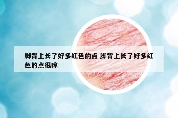 腳背上長(zhǎng)了好多紅色的點(diǎn) 腳背上長(zhǎng)了好多紅色的點(diǎn)很癢