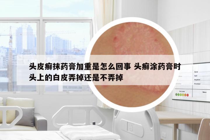 頭皮癬抹藥膏加重是怎么回事 頭癬涂藥膏時(shí)頭上的白皮弄掉還是不弄掉