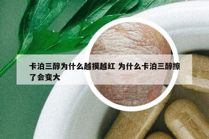 卡泊三醇為什么越摸越紅 為什么卡泊三醇擦了會變大