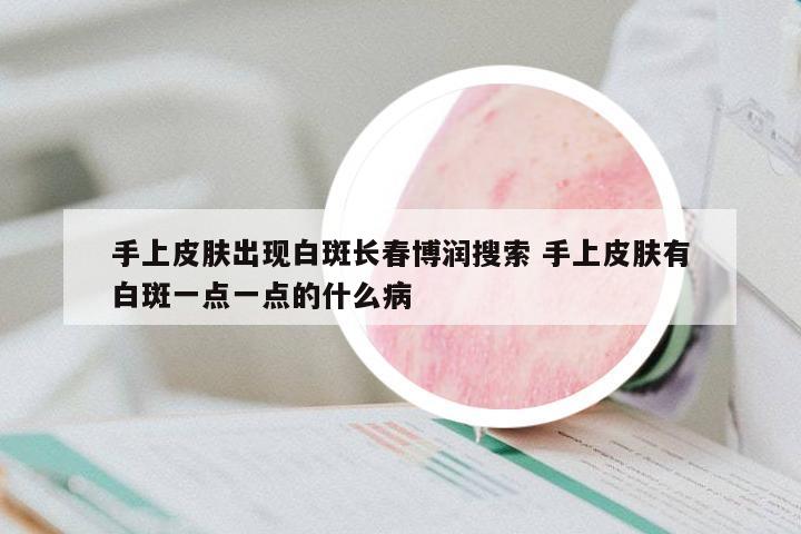 手上皮膚出現(xiàn)白斑長(zhǎng)春博潤(rùn)搜索 手上皮膚有白斑一點(diǎn)一點(diǎn)的什么病