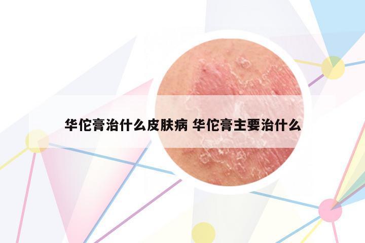 華佗膏治什么皮膚病 華佗膏主要治什么